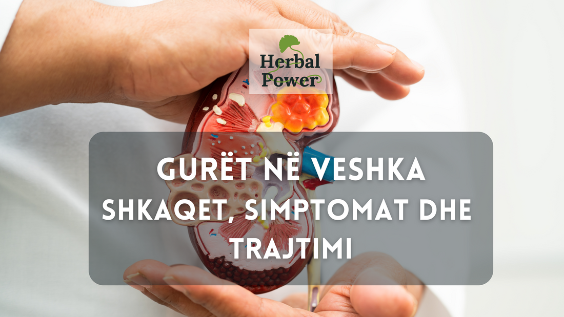 Gurët në veshka: Shkaqet, simptomat dhe trajtimi