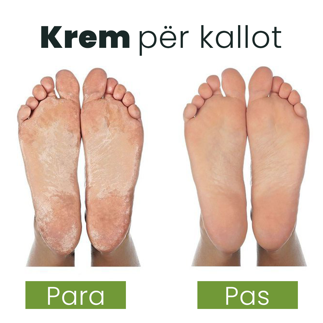 Krem për Kallot