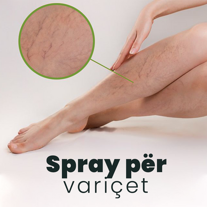 Spray për variçet